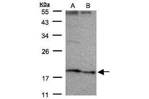 WB Image Sample(30 μg of whole cell lysate) A:HeLa S3, B:Hep G2, 12% SDS PAGE antibody diluted at 1:500 (SCN3B Antikörper  (Center))