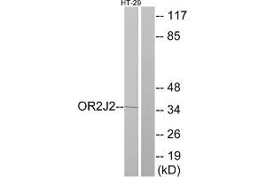 Western Blotting (WB) image for anti-Olfactory Receptor, Family 2, Subfamily J, Member 2 (OR2J2) (C-Term) antibody (ABIN1853218) (OR2J2 Antikörper  (C-Term))
