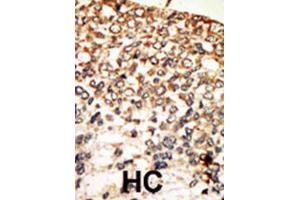 Immunohistochemistry (IHC) image for anti-PKA C-Alpha,PKA C-beta antibody (ABIN3002928) (PKA C-Alpha,PKA C-beta Antikörper)