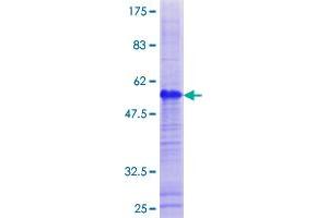 Image no. 1 for G Antigen 1 (GAGE1) (AA 1-139) protein (GST tag) (ABIN1354684)