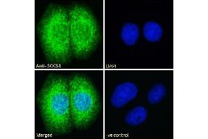 Immunofluorescence (IF) image for anti-Suppressor of Cytokine Signaling 1 (SOCS1) (C-Term) antibody (ABIN184575)