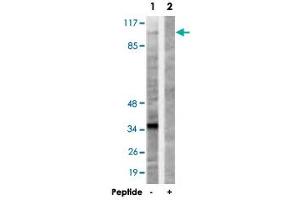 Western blot analysis of extracts from 293 cells, using KIF20A polyclonal antibody . (KIF20A Antikörper)