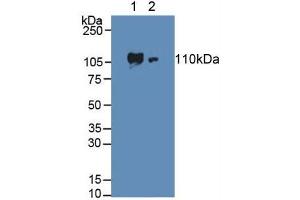 Western blot analysis of (1) Human HeLa cells and (2) Human Lung Tissue. (ADCY3 Antikörper  (AA 501-736))