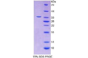 SDS-PAGE analysis of Human TOMM70A Protein.