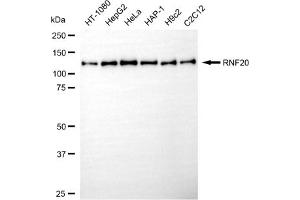 anti-Ring Finger Protein 20 (RNF20) antibody