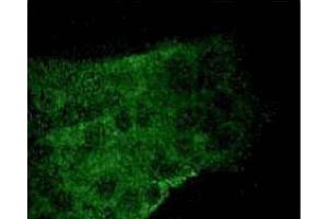 Immunofluorescence (IF) image for anti-Signal Transducer and Activator of Transcription 3 (Acute-Phase Response Factor) (STAT3) (pSer727) antibody (ABIN968869)
