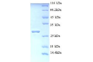 SDS-PAGE (SDS) image for Titin (TTN) (AA 5398-5604), (partial) protein (His tag) (ABIN5712956) (Titin Protein (TTN) (AA 5398-5604, partial) (His tag))