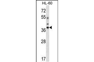 Western blot analysis in HL-60 cell line lysates (35ug/lane). (DLX5 Antikörper  (AA 100-128))
