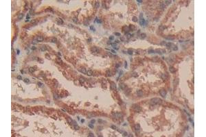 Immunohistochemistry (IHC) image for anti-Caspase 3 (CASP3) (AA 29-175) antibody (ABIN7442660)