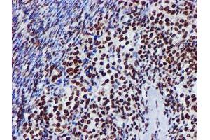 Image no. 2 for anti-Glutathione S-Transferase theta 2 (GSTT2) antibody (ABIN1498553) (GSTT2 Antikörper)