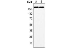 Western blot analysis of Factor VIII expression in HeLa (A), HepG2 (B) whole cell lysates. (Factor VIII Antikörper  (C-Term))