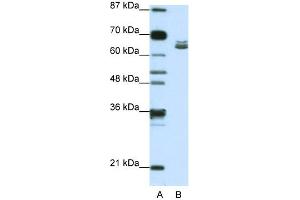 WB Suggested Anti-ZFP57 Antibody Titration:  1. (ZFP57 Antikörper  (N-Term))