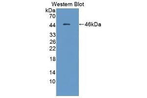 Western Blotting (WB) image for anti-Complement Factor B (CFB) (AA 34-159) antibody (ABIN1858376) (Complement Factor B Antikörper  (AA 34-159))