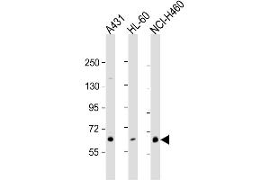 Western Blotting (WB) image for anti-Protein Kinase C, eta (PRKCH) antibody (ABIN3002933) (PKC eta Antikörper)