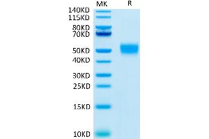 Human CD24 on Tris-Bis PAGE under reduced condition. (CD24 Protein (AA 27-59) (Llama Fc Tag))
