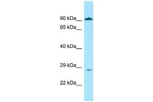 WB Suggested Anti-GLIPR1 Antibody Titration: 1. (GLIPR1 Antikörper  (Middle Region))