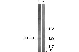 Western blot analysis of extracts from A431 cells, using EGFR (Ab-693) antibody (#B0009, Line 1 and 2).