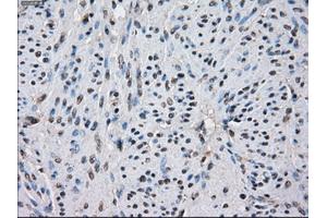 Immunohistochemical staining of paraffin-embedded colon tissue using anti-IDH1 mouse monoclonal antibody. (IDH1 Antikörper)
