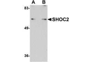 Western Blotting (WB) image for anti-Leucine-rich repeat protein SHOC-2 (SHOC2) (N-Term) antibody (ABIN1031560) (SHoc2/Sur8 Antikörper  (N-Term))