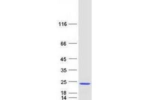 Western Blotting (WB) image for Complexin 2 (CPLX2) (Transcript Variant 2) protein (Myc-DYKDDDDK Tag) (ABIN2712471)