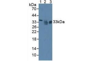 Western blot analysis of (1) Mouse Liver Tissue, (2) Human HeLa cells and (3) Human PC-3 Cells. (SIRT4 Antikörper  (AA 26-333))