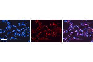 NR2F6 antibody - N-terminal region          Formalin Fixed Paraffin Embedded Tissue:  Human Lung Tissue    Observed Staining:  Nucleus of pneumocytes   Primary Antibody Concentration:  1:100    Other Working Concentrations:  1/600    Secondary Antibody:  Donkey anti-Rabbit-Cy3    Secondary Antibody Concentration:  1:200    Magnification:  20X    Exposure Time:  0. (NR2F6 Antikörper  (N-Term))