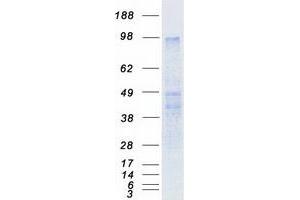 Western Blotting (WB) image for Prokineticin Receptor 2 (PROKR2) protein (Myc-DYKDDDDK Tag) (ABIN2722195)