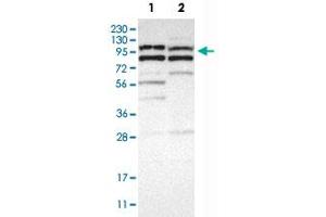 Western Blot analysis of Lane 1: RT-4 and Lane 2: U-251MG sp cell lysates with KIAA1804 polyclonal antibody .
