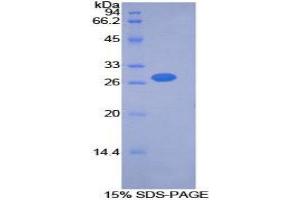SDS-PAGE (SDS) image for Pyruvate Dehydrogenase Kinase, Isozyme 2 (PDK2) (AA 155-379) protein (His tag) (ABIN1877871) (PDK2 Protein (AA 155-379) (His tag))