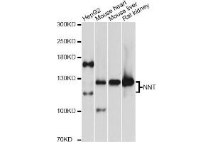 Western blot analysis of extracts of various cell lines, using NNT antibody (ABIN5972604) at 1:3000 dilution. (NNT Antikörper)