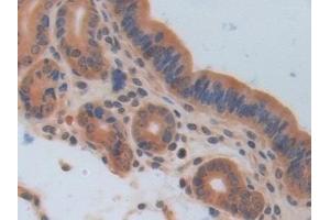 Detection of IL17RA in Mouse Uterus Tissue using Polyclonal Antibody to Interleukin 17 Receptor A (IL17RA)