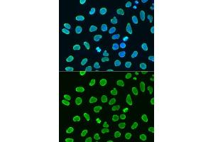 Immunohistochemistry (IHC) image for anti-Histone H4 (acLys8) antibody (ABIN7267747)