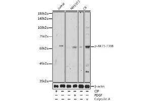 Western blot analysis of extracts of various cell lines, using Phospho--T308 antibody (ABIN3020075, ABIN3020076, ABIN3020077 and ABIN6225508) at 1:500 dilution. (AKT1 Antikörper  (pThr308))