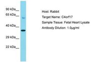 Image no. 1 for anti-Chromosome 4 Open Reading Frame 17 (C4ORF17) (AA 136-185) antibody (ABIN6750545)