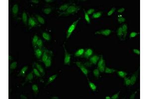 Immunofluorescent analysis of Hela cells using ABIN7160017 at dilution of 1:100 and Alexa Fluor 488-congugated AffiniPure Goat Anti-Rabbit IgG(H+L) (MAP3K11 Antikörper  (AA 536-693))