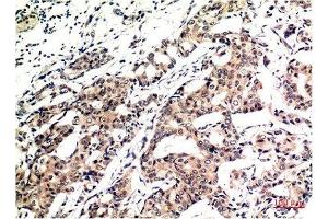 Immunohistochemistry (IHC) image for anti-Ubiquitin (Ub) antibody (ABIN7193134)