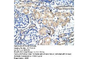 Immunohistochemistry (IHC) image for anti-Potassium Voltage-Gated Channel, Shaker-Related Subfamily, beta Member 2 (KCNAB2) (Middle Region) antibody (ABIN2780205)