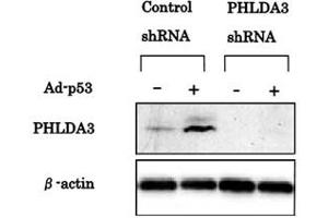 Western blotting was performed using PHLDA3 monoclonal antibody, clone 4B6  to detect PHLDA3 protein expression. (PHLDA3 Antikörper  (AA 1-31))