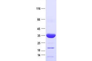 Validation with Western Blot (mCherry Protein (His tag))
