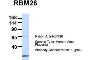 Host:  Rabbit  Target Name:  RBM26  Sample Type:  Human Adult Placenta  Antibody Dilution:  1. (RBM26 Antikörper  (Middle Region))