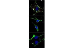 Fluorescent confocal image of SY5Y cells stained with KIT antibody at 1:50. (KIT Antikörper)