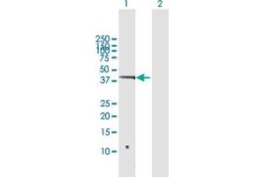 Western Blot analysis of SNIP1 expression in transfected 293T cell line by SNIP1 MaxPab polyclonal antibody. (SNIP1 Antikörper  (AA 1-396))