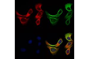 ABIN6257219 and ABIN6276016 staining Hela cells by IF/ICC. (GPR153 Antikörper  (Internal Region))