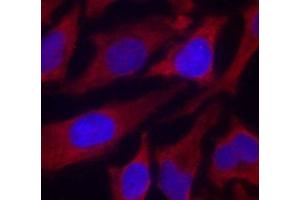 Immunofluorescence analysis of methanol-fixed HeLa cells using Phospho-SYN1(S9) Polyclonal Antibody (SYN1 Antikörper  (pSer9))