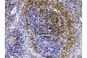 Immunohistochemistry (IHC) image for anti-V-Yes-1 Yamaguchi Sarcoma Viral Related Oncogene Homolog (LYN) (AA 470-501) antibody (ABIN5647656)
