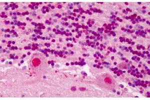 Human Brain, Cerebellum: Formalin-Fixed, Paraffin-Embedded (FFPE) (RBX1 Antikörper  (C-Term))