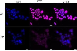 Immunocytochemical staining of HeLa cells using PTBP1 antibody (ABIN7799882), 1:1,000), Top panel: wild-type (WT), Bottom panal: PTBP1 shRNA knockdown (KD). (Rekombinanter PTBP1 Antikörper)