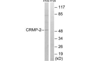 Western blot analysis of extracts from HT-29 cells, treated with heat shock, using CRMP2 (epitope around residue 509) antibody. (DPYSL2 Antikörper  (Thr509))