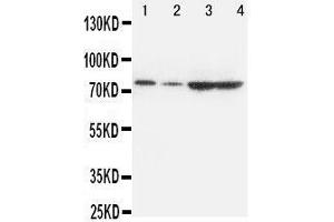 Western Blotting (WB) image for anti-Proprotein Convertase Subtilisin/kexin Type 9 (PCSK9) (AA 671-687), (C-Term) antibody (ABIN3042887) (PCSK9 Antikörper  (C-Term))
