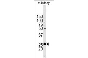 Western blot analysis of anti-STC2 Antibody in mouse kidney tissue lysates (35ug/lane). (Stanniocalcin 2 Antikörper  (N-Term))